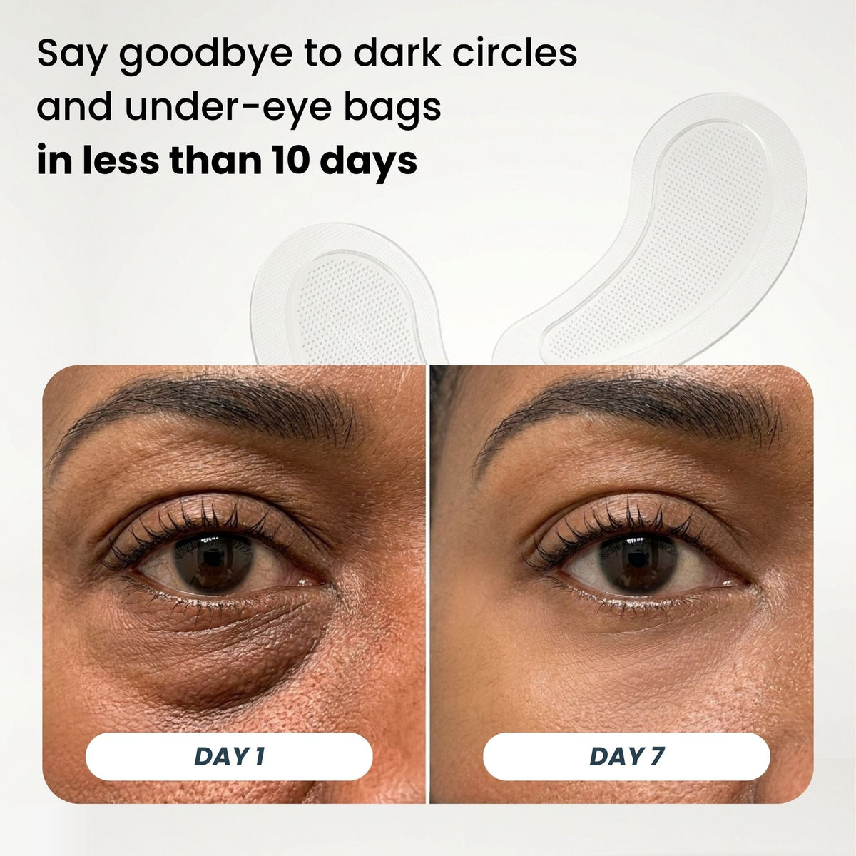 Microneedle Patches | New Generation
